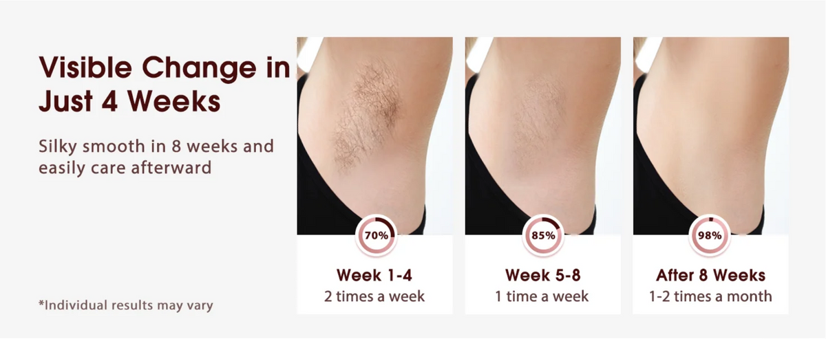 Treatment schedule: twice a week for weeks 1 to 4, once a week for weeks 5 to 8, then 1 to 2 times a month. Individual results may vary