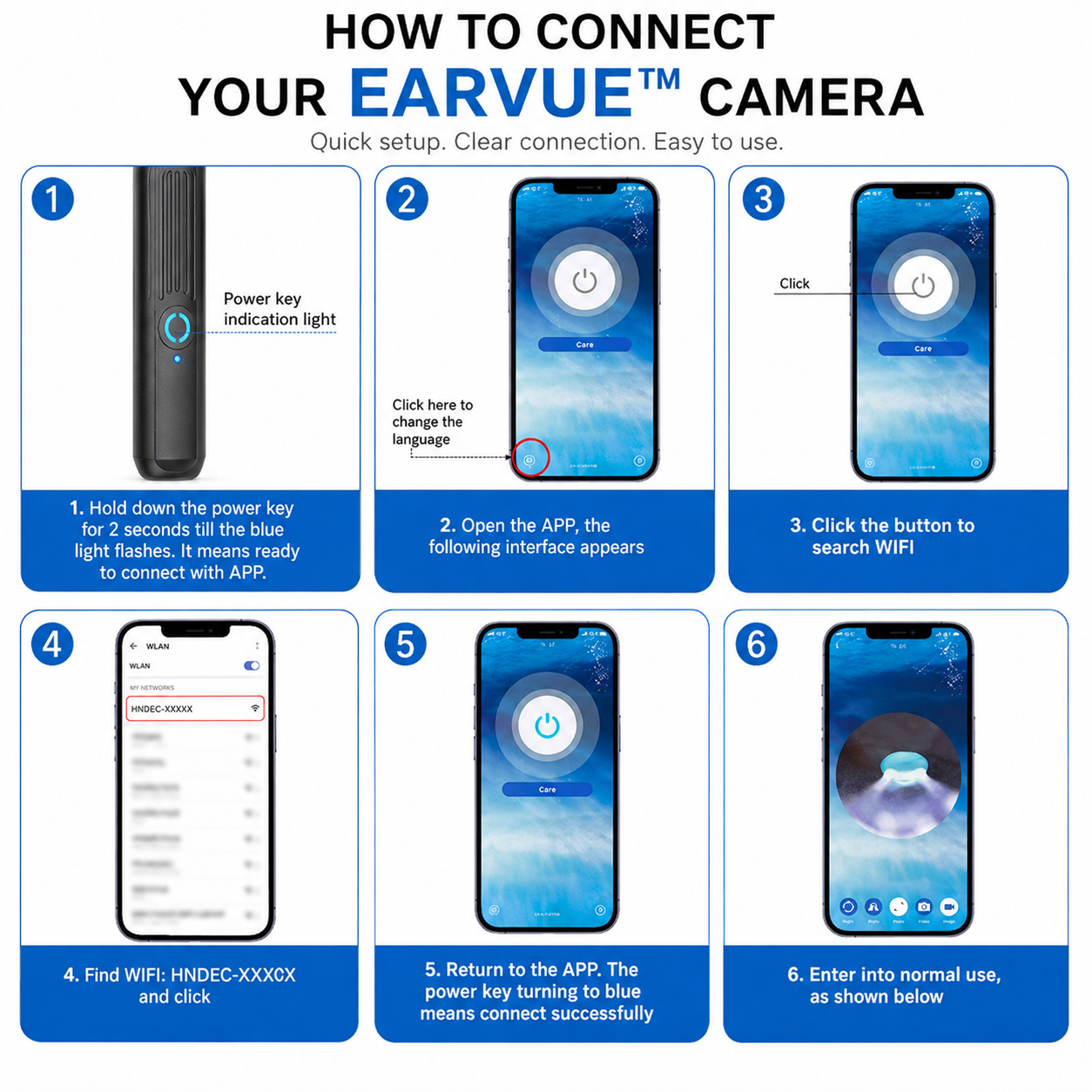 EarVue™ Ear Wax Removal Camera
